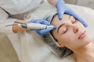 Laser Treatment for Facial Veins