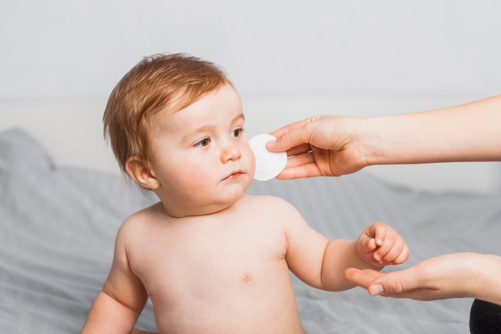 baby acne treatment