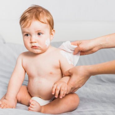baby skin rashes