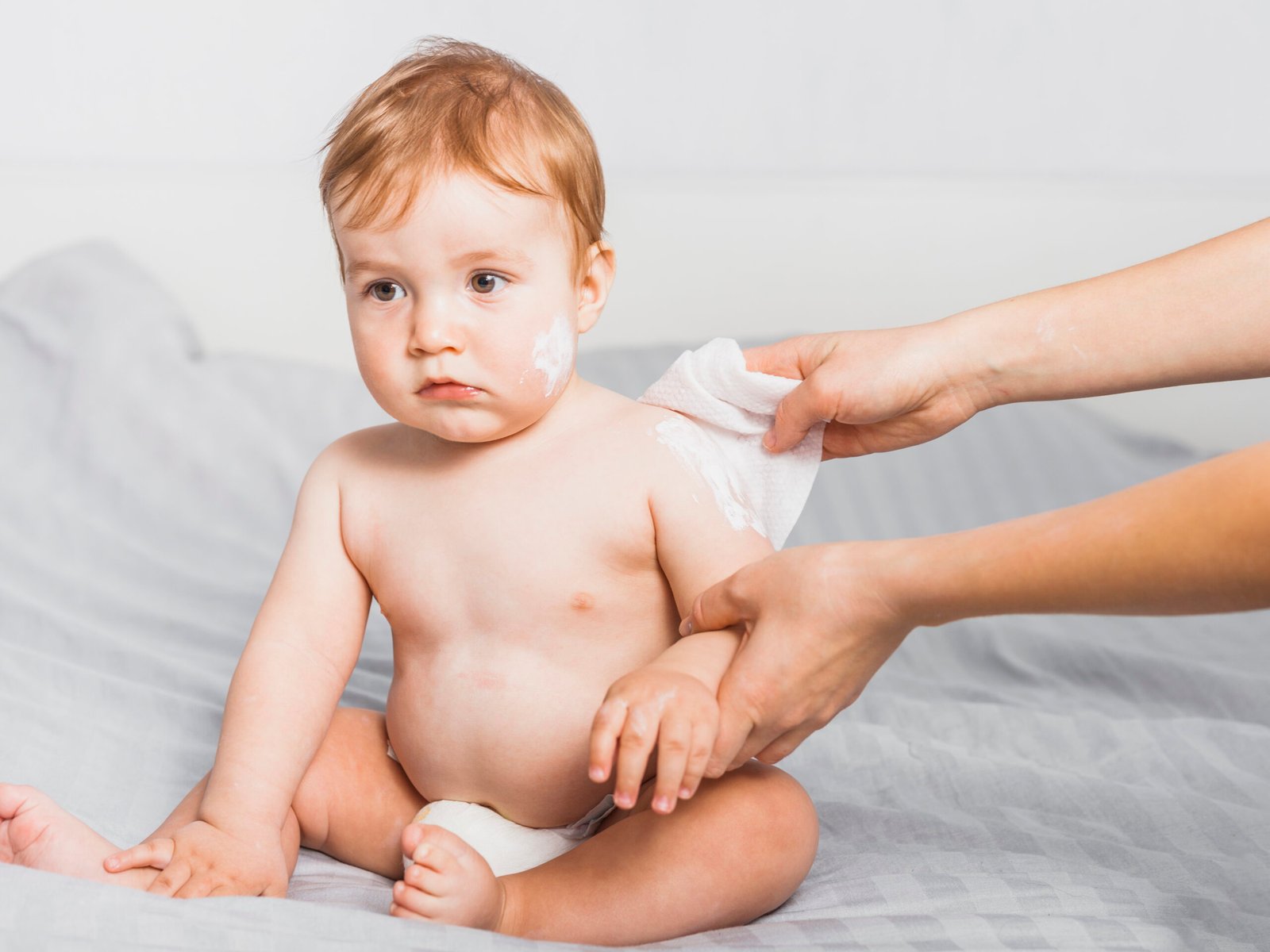 baby skin rashes