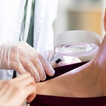 skin cancer treatments