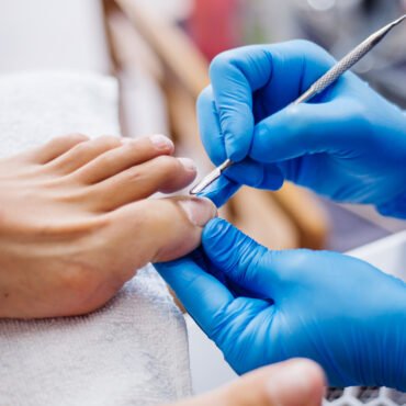 toenail fungus home treatment