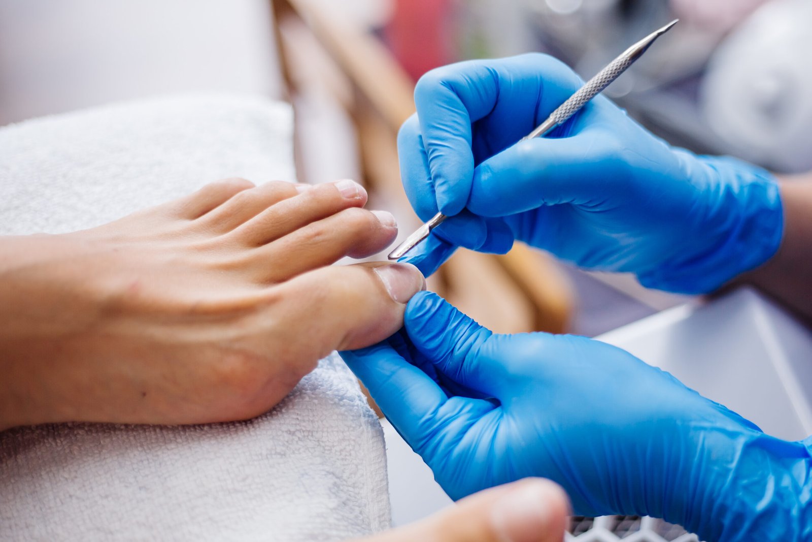 toenail fungus home treatment