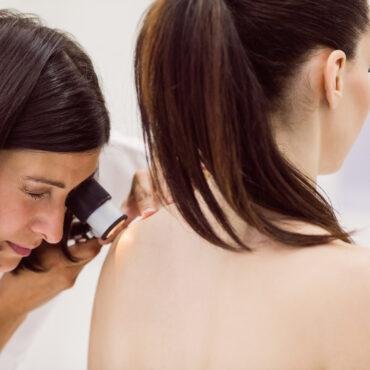 Back acne treatment- Golla center for dermatology