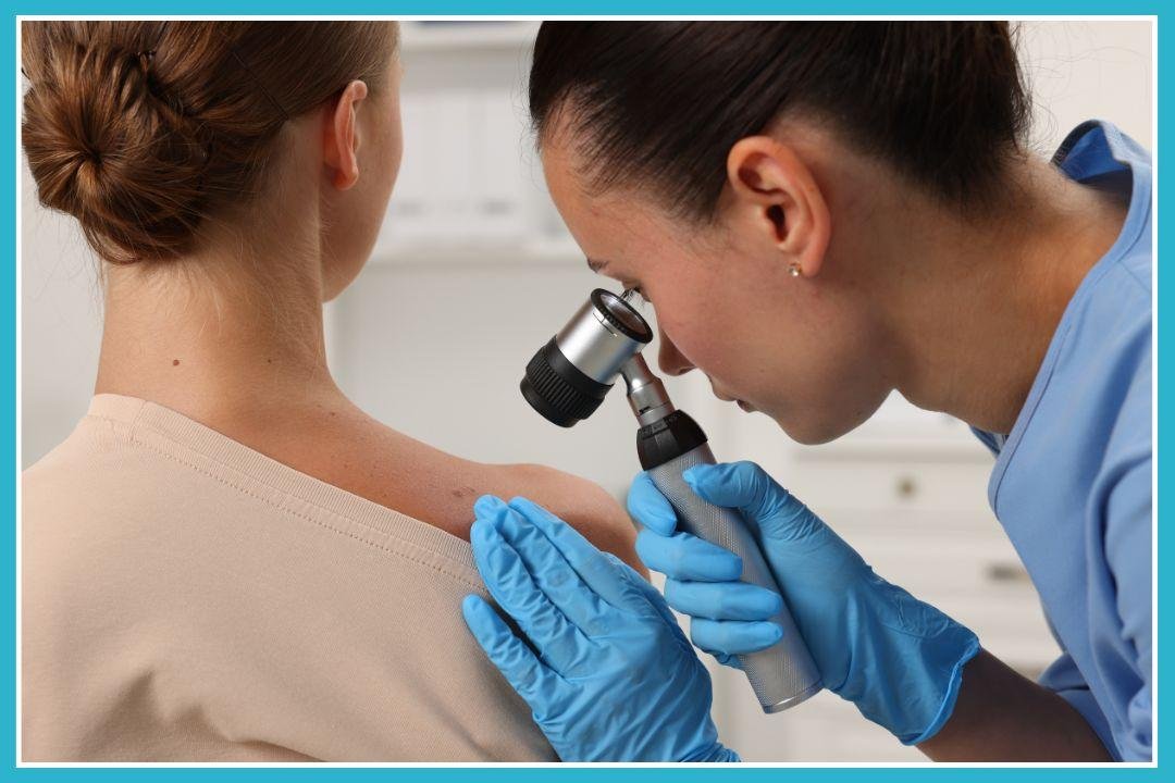 dermatologist skin cancer screening